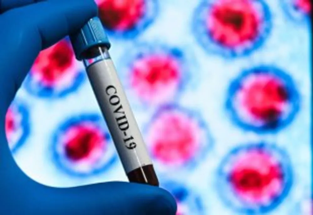 Peste 15 000 de cazuri ale îmbolnăvirilor cu coronavirus  în România. 320 de cazuri noi