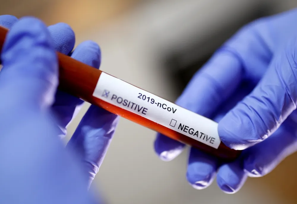 Încă 19 cazuri de infecție cu coronavirus, la Buzău. Județul ajunge să numere 369 de bolnavi