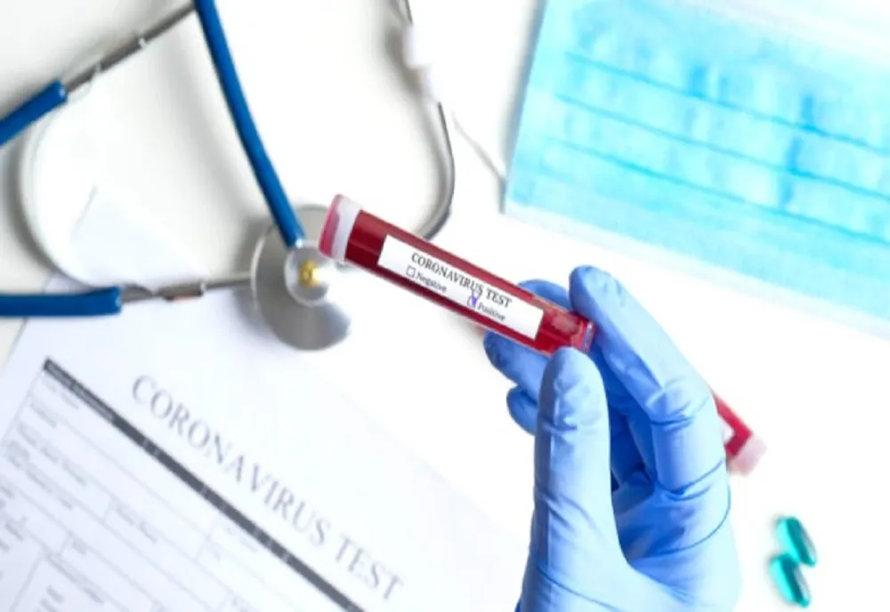  Bilanț coronavirus 20 august: 1.346 de cazuri noi de persoane infectate cu SARS-CoV-2, 48 de persoane au decedat și 489 sunt internate la ATI