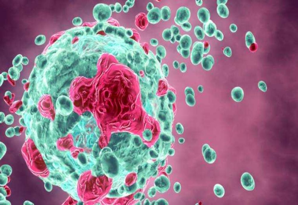 TRATAMENT REVOLUȚIONAR CONTRA CANCERULUI: NOUL ANTICORP 2141-V11 A ELIMINAT COMPLET TUMORILE LA DOI PACIENȚI