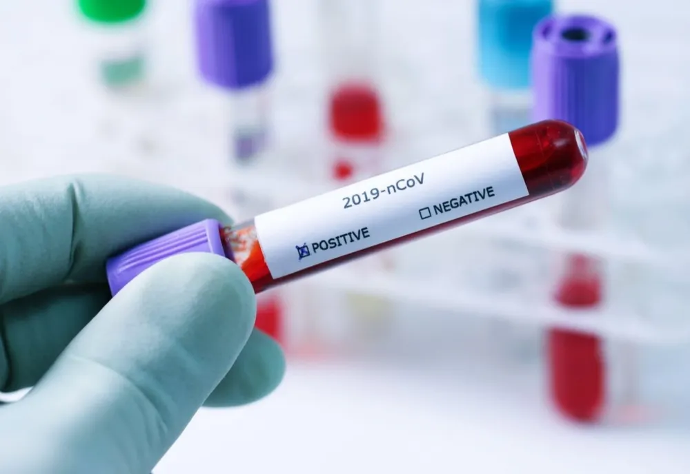 42 de cazuri noi și 5 decese ale unor pacienți infectați cu COVID-19