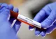 Încă 19 cazuri de infecție cu coronavirus, la Buzău. Județul ajunge să numere 369 de bolnavi