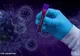 72 de persoane au fost diagnosticate cu COVID-19